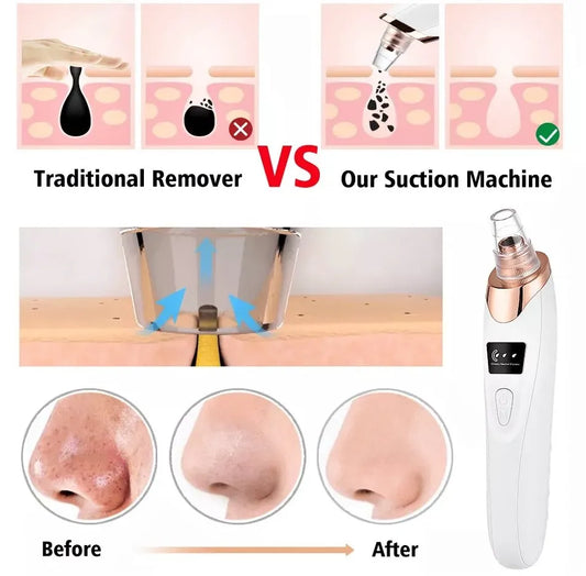 Electric Blackhead Remover – Rechargeable Facial Pore Vacuum Cleaner with 6 Suction Heads