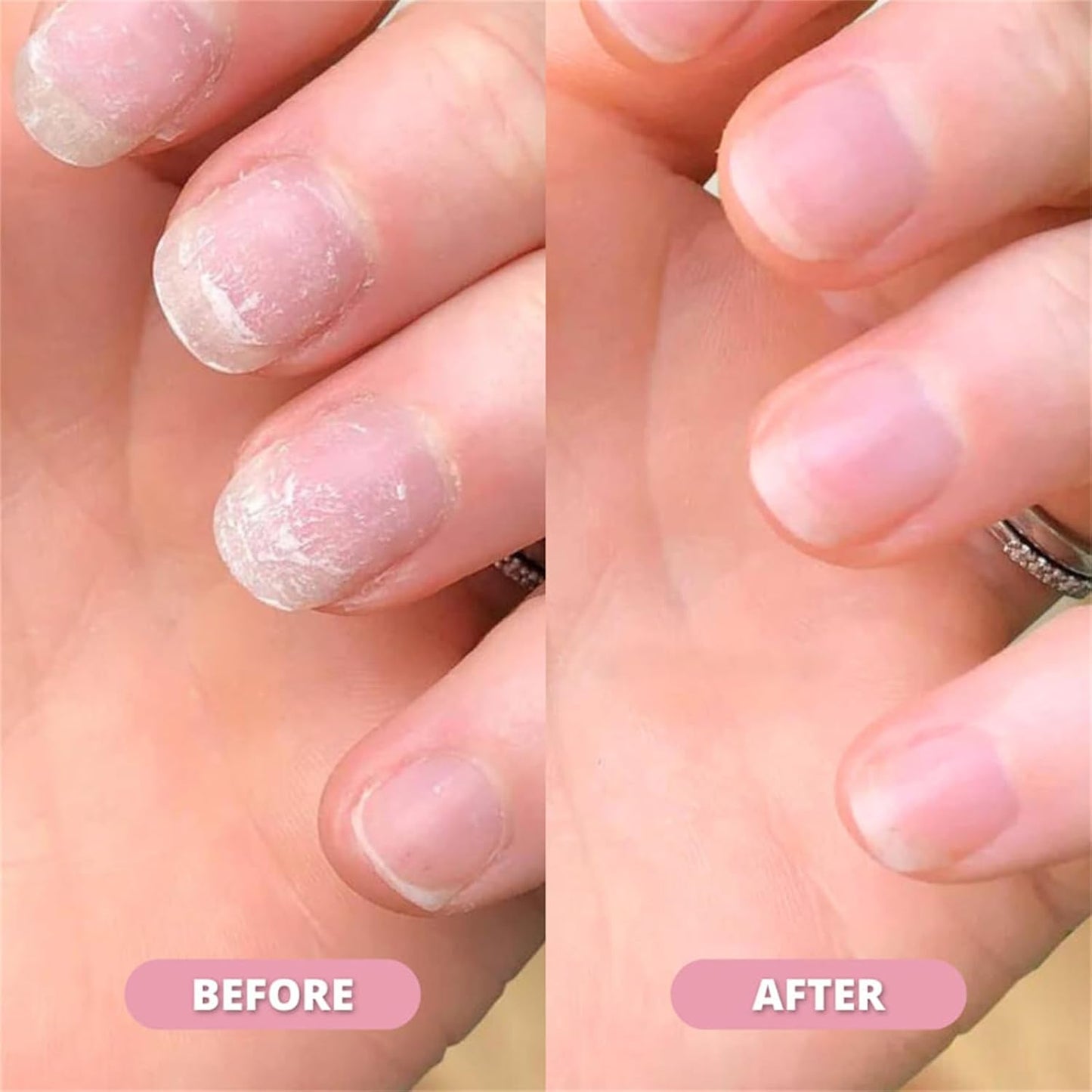 Nail Growth Oil Pen – Nourishing Cuticle Repair Treatment for Strong & Healthy Nails