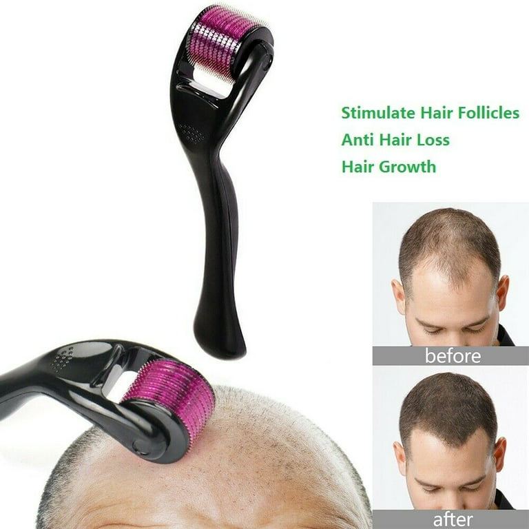 Derma Roller for Hair Growth – Microneedle Scalp Roller for Men & Women (Titanium Needles)