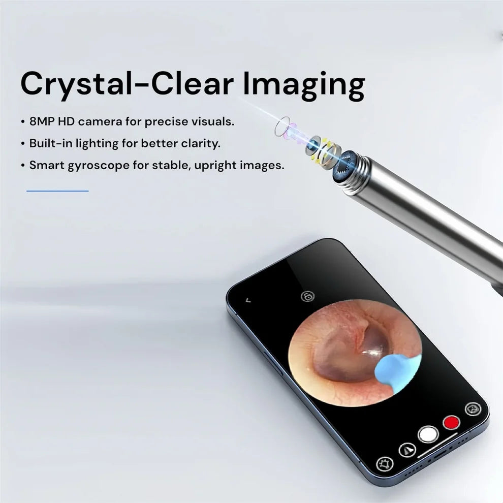 Smart Visual Ear Cleaner – WiFi Ear Wax Removal Camera with HD Otoscope (Phone Connected)