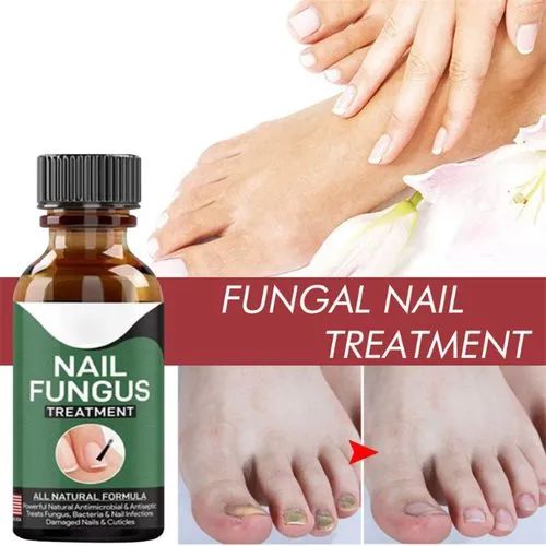 Foot Cure Nail Fungus Treatment Oil – All-Natural Antimicrobial Formula for Finger & Toenail Care
